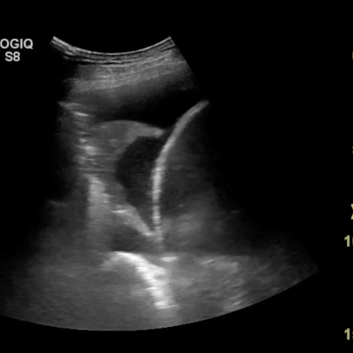 Skærmbillede 2023-10-23 kl. 11.18.31